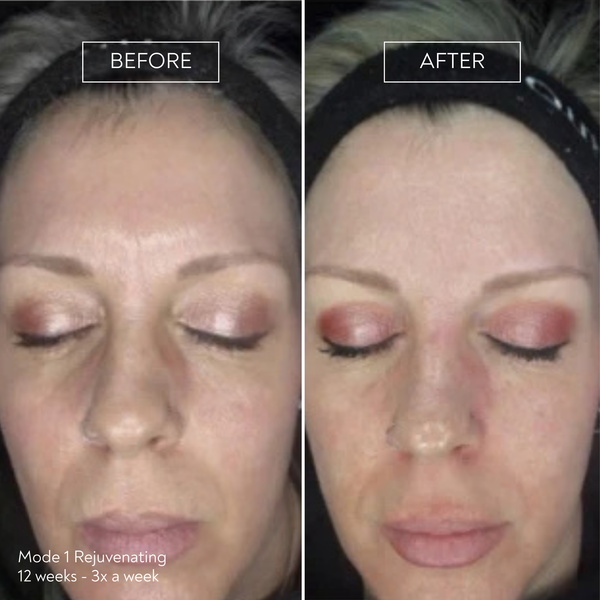 PRO by Déesse PRO LED Mask
