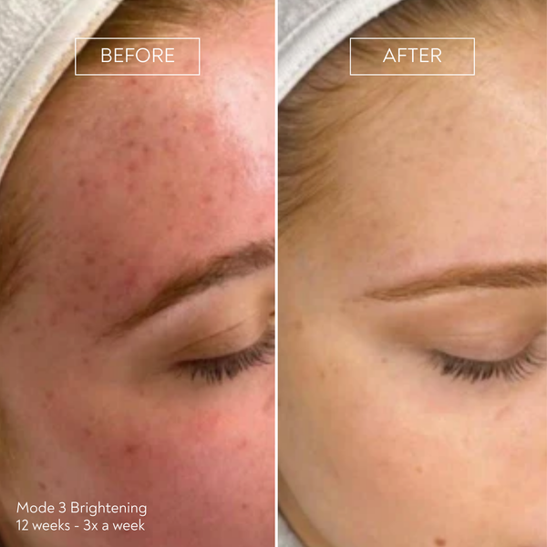 PRO by Déesse PRO LED Mask