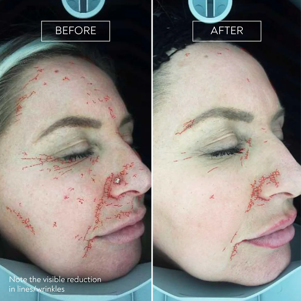Express by Déesse PRO LED Mask