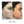 Before and after skin treatment comparison showing improvement in skin texture and clarity.