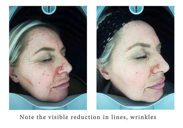 Express by Déesse PRO LED Mask