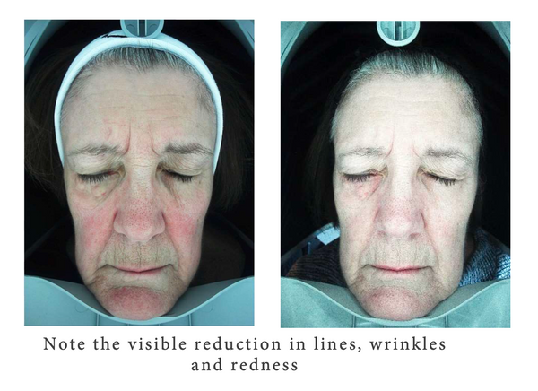 Express by Déesse PRO LED Mask