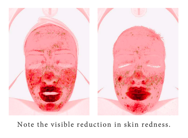 Express by Déesse PRO LED Mask